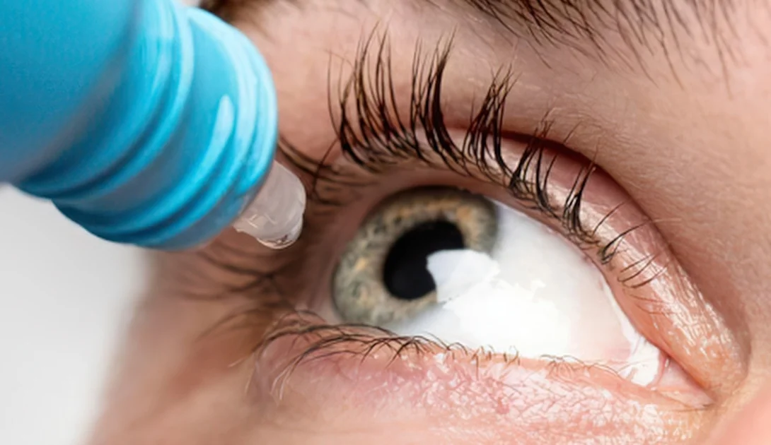 Eye drops recall
