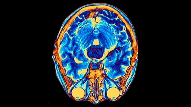 Textbook Rewrite: The Human Brain Has Two Distinct Origins, Scientists Discover